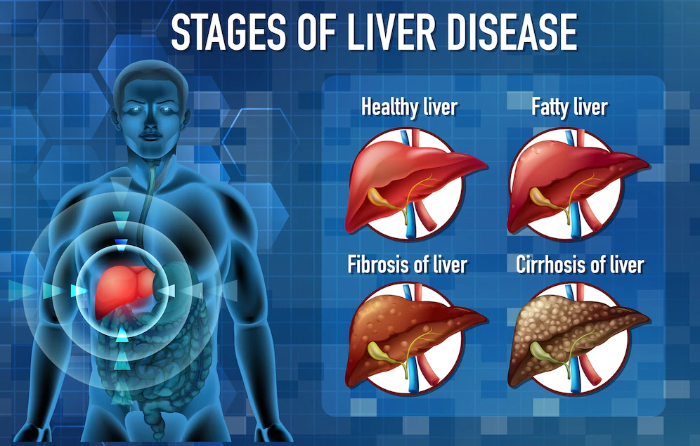 liver diseases